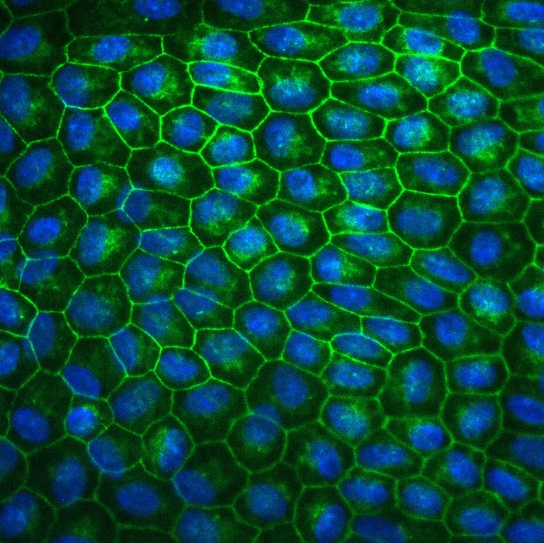 Fluoreszenzmikroskopische Aufnahme