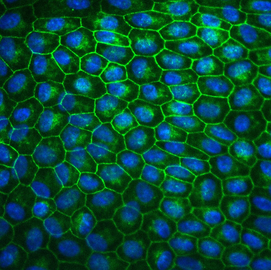 Fluoreszenzmikroskopische Aufnahme