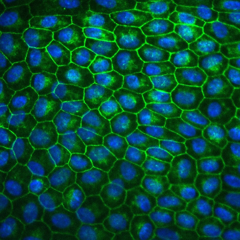 Fluoreszenzmikroskopische Aufnahme