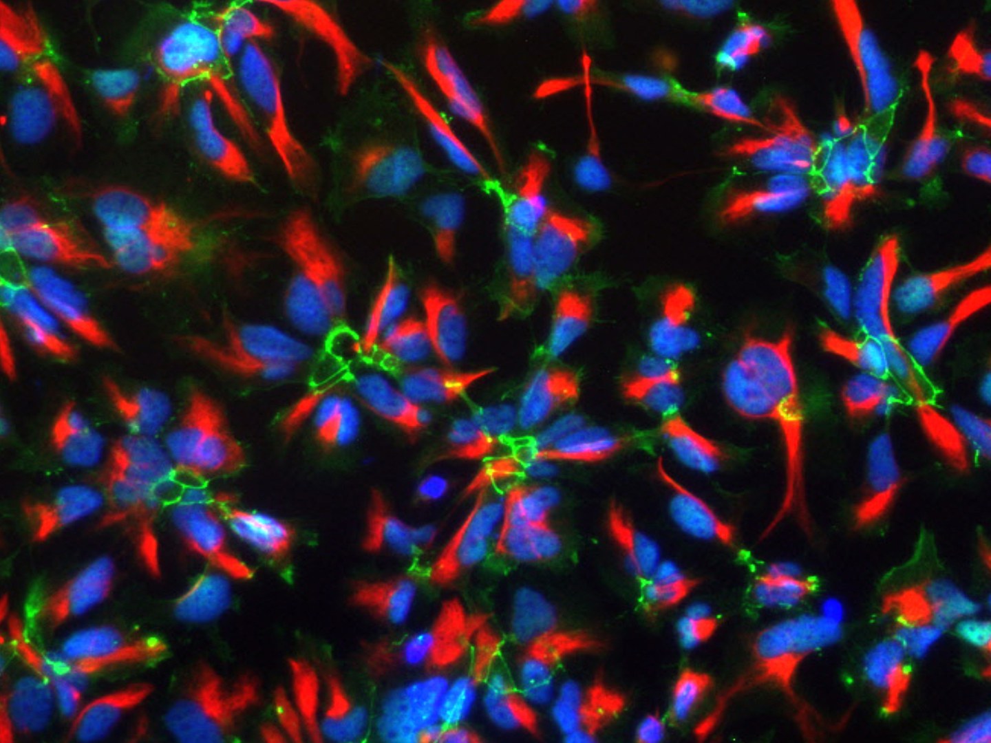 Neurale-Stammzellen.jpg