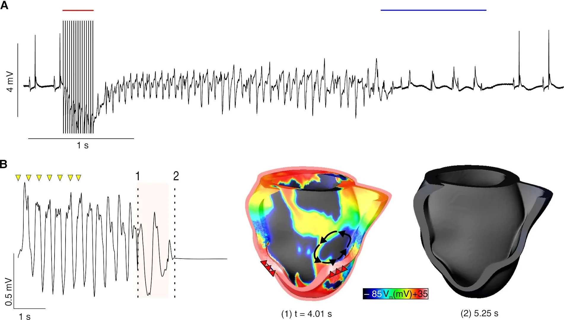 A: Optogenetische Defibrillation (blauer Balken)