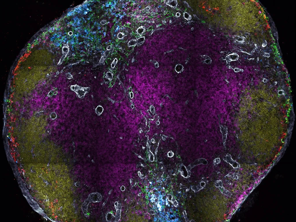 Querschnitt eines Lymphknotens: