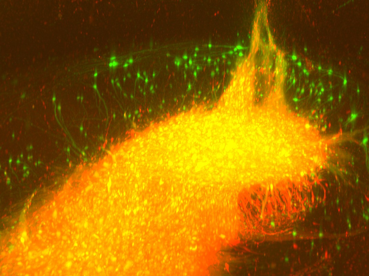 Transplantat menschlicher Nervenzellen im Hippocampus einer Maus: