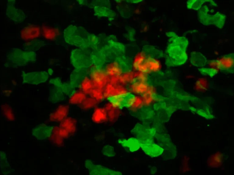 Sobald Killerzellen (rot)
