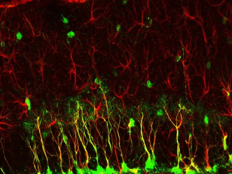 Aufnahme des Hippocampus einer Maus: