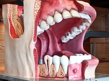 Dieses riesige Modell einer Mundhöhle