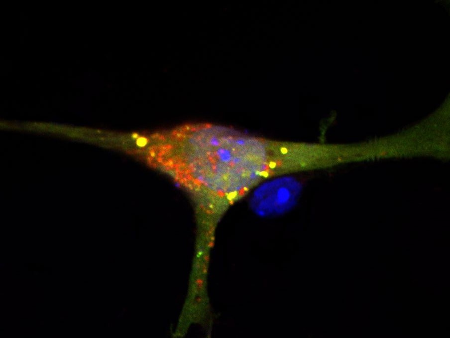 Nervenzelle mit gestörtem S1P-Abbau: