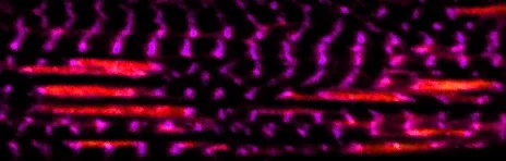In einer Muskelfaser zerstört mechanische Belastung