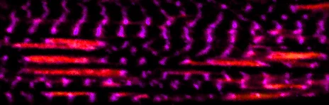 In einer Muskelfaser zerstört mechanische Belastung
