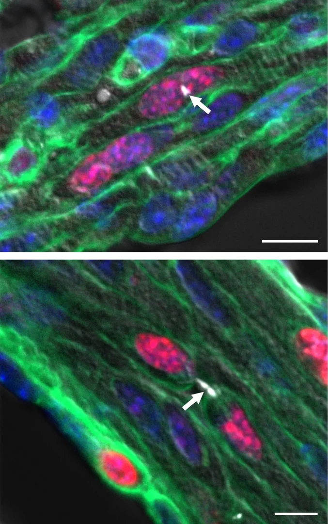 Abbildung einer mehrkernig werdenden (oben) und einer sich teilenden Herzmuskelzelle (unten)