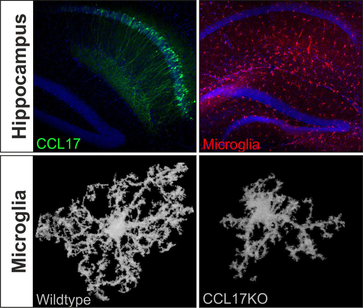 Oben: CCL17-produzierende Neurone