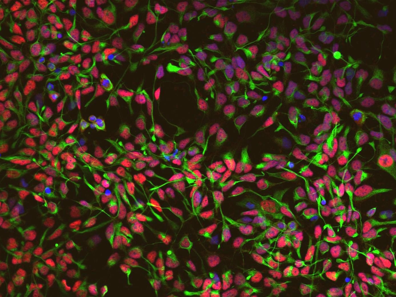 Auf dem Bild sind direkt induzierte neurale Stammzellen (iNSC) zu erkennen.