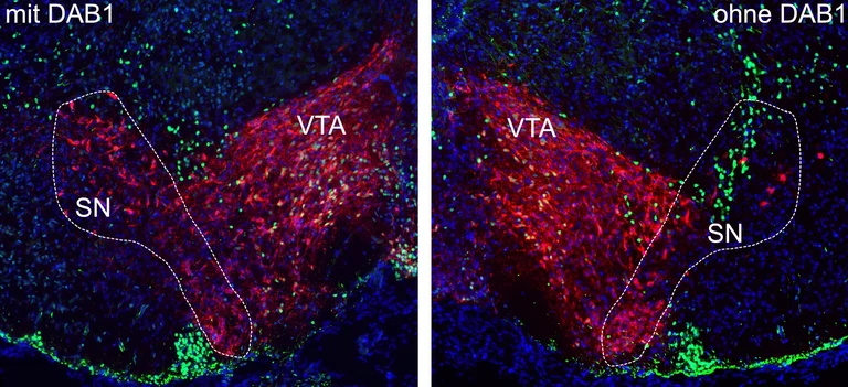 Substantia Nigra (SN) und ventrales Tegmentum (VTA) im sich entwickelnden Gehirn: