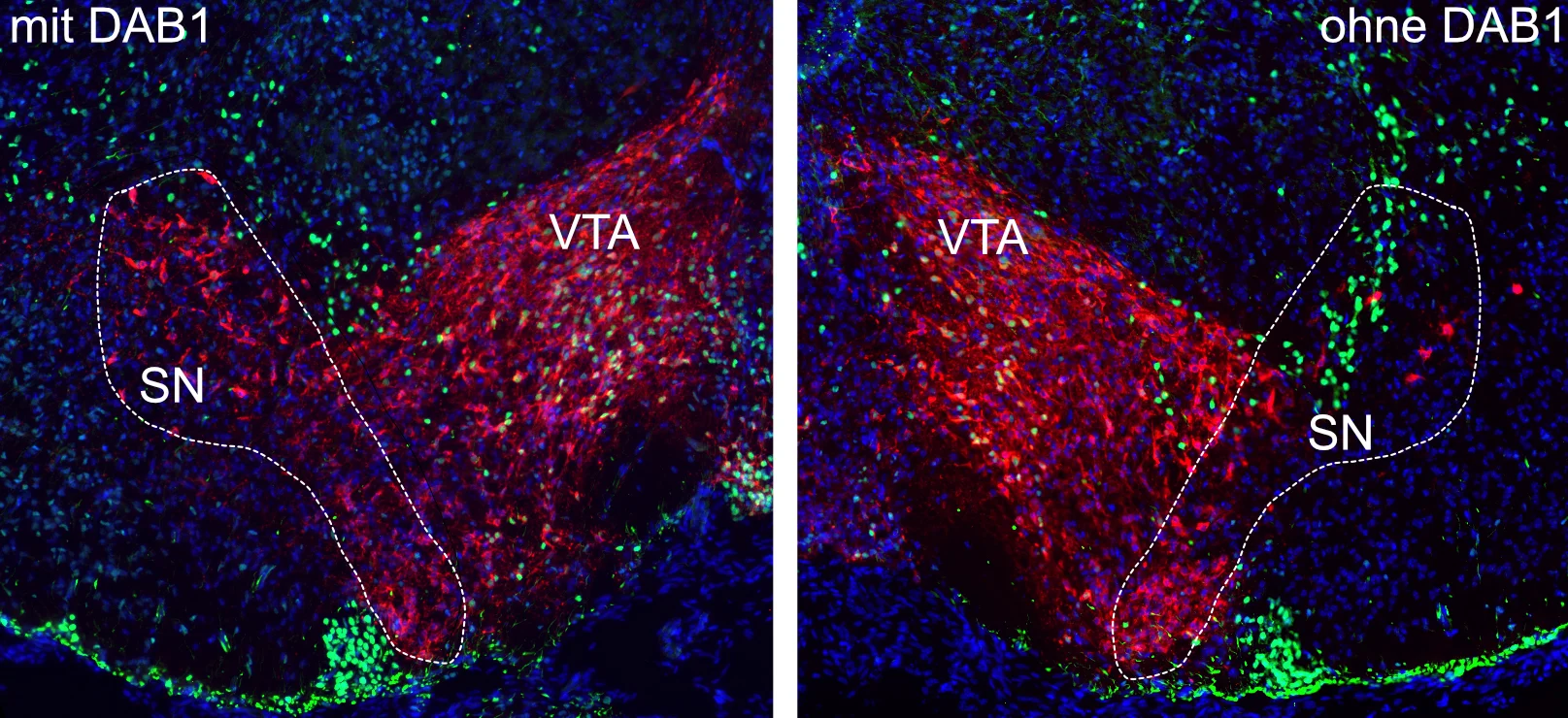 Substantia Nigra (SN) und ventrales Tegmentum (VTA) im sich entwickelnden Gehirn: