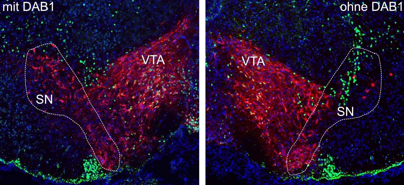 Substantia Nigra (SN) und ventrales Tegmentum (VTA) im sich entwickelnden Gehirn: