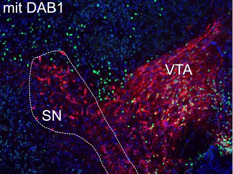 Substantia Nigra (SN) und ventrales Tegmentum (VTA)