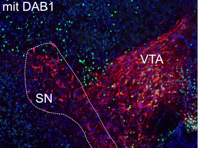 Substantia Nigra (SN) und ventrales Tegmentum (VTA)