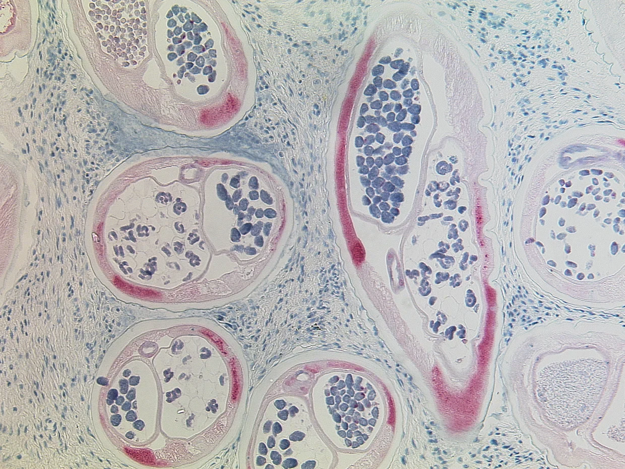 Histologischer Schnitt von Onchocerca volvulus, dem Erreger der Flussblindheit, unter dem Mikroskop: