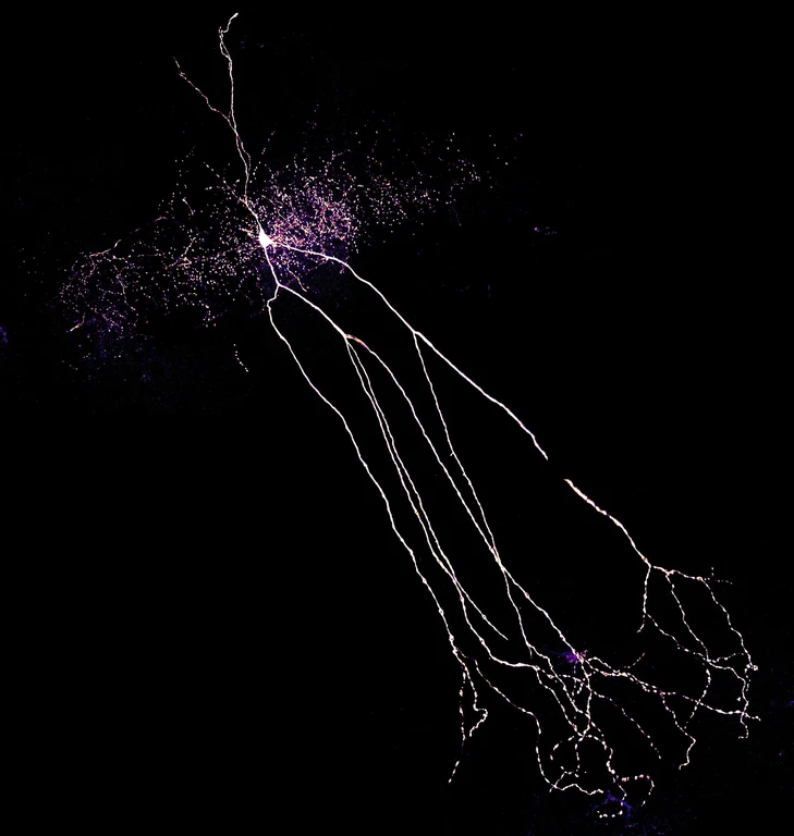 Ein Interneuron