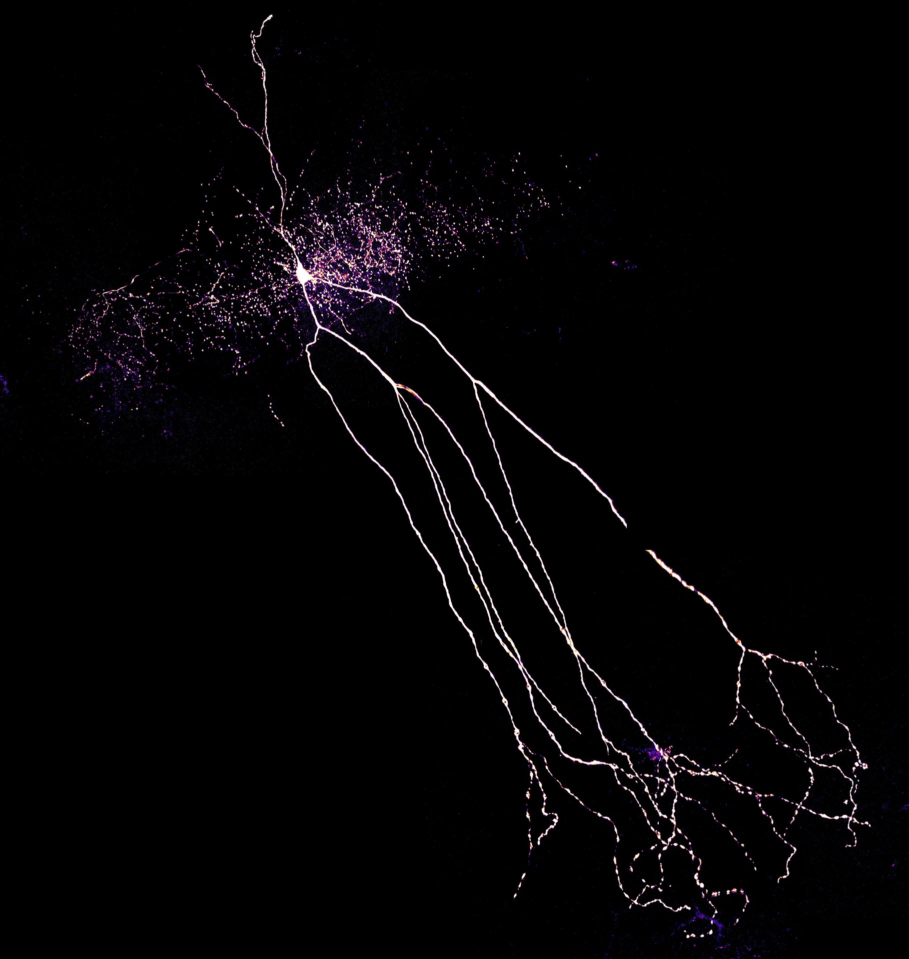 Ein Interneuron
