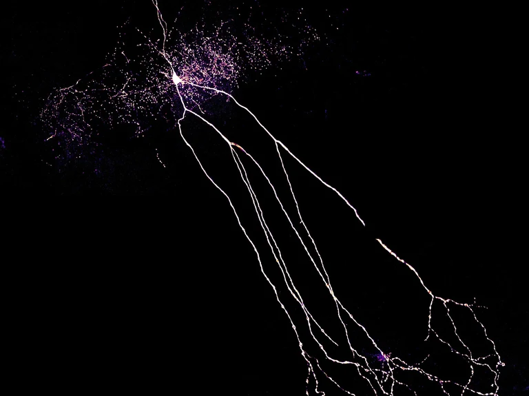 Ein Interneuron
