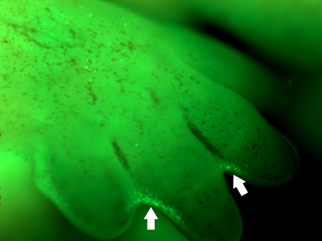 Durch Apoptose bauen sich unter anderem die Zellen ab (grün),