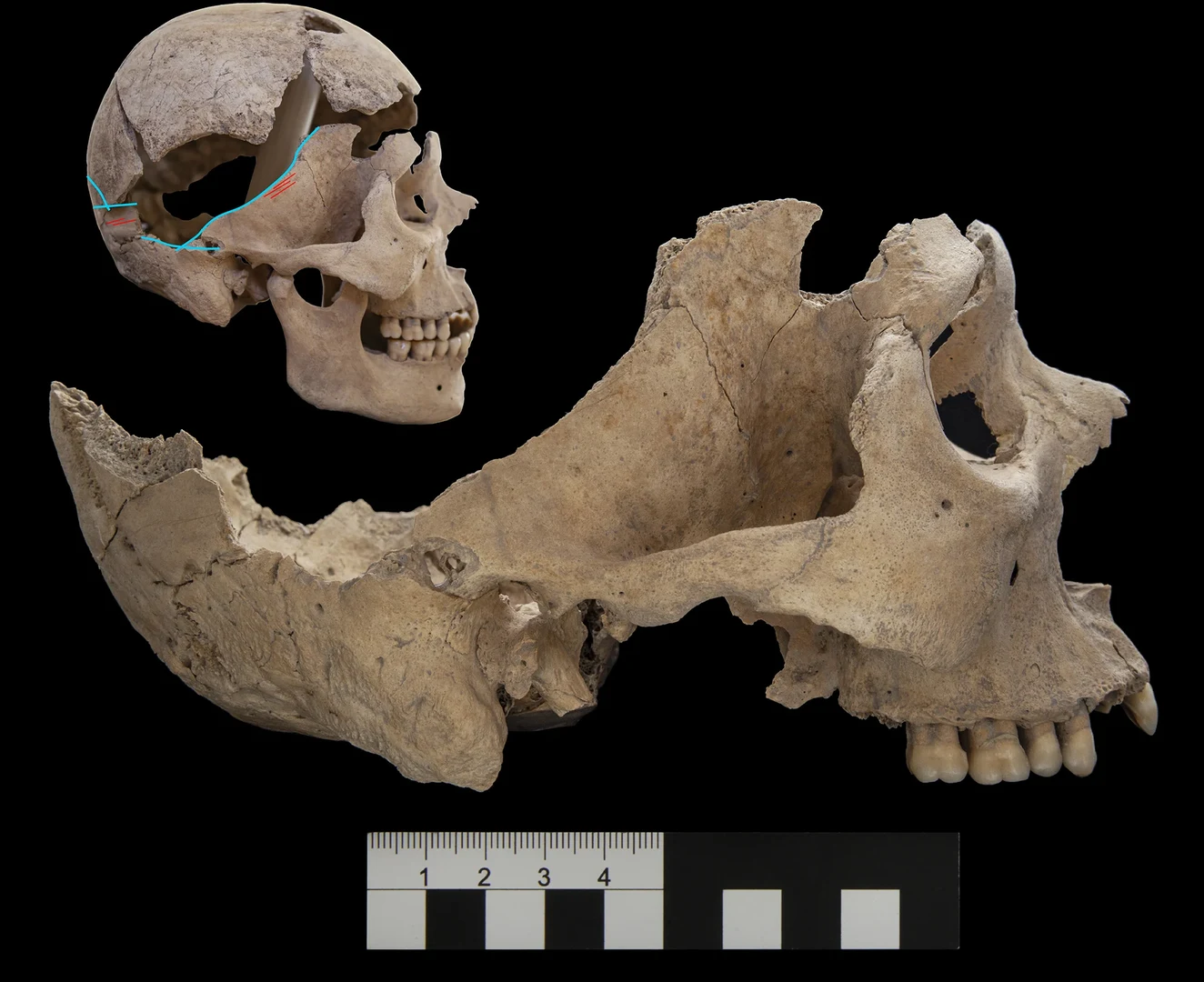 Schnittspuren (rote Striche) und Frakturen (hellblaue Linie)