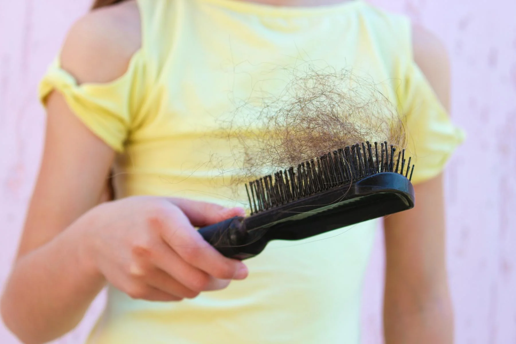 Inflammatory diseases influence the course of hair loss