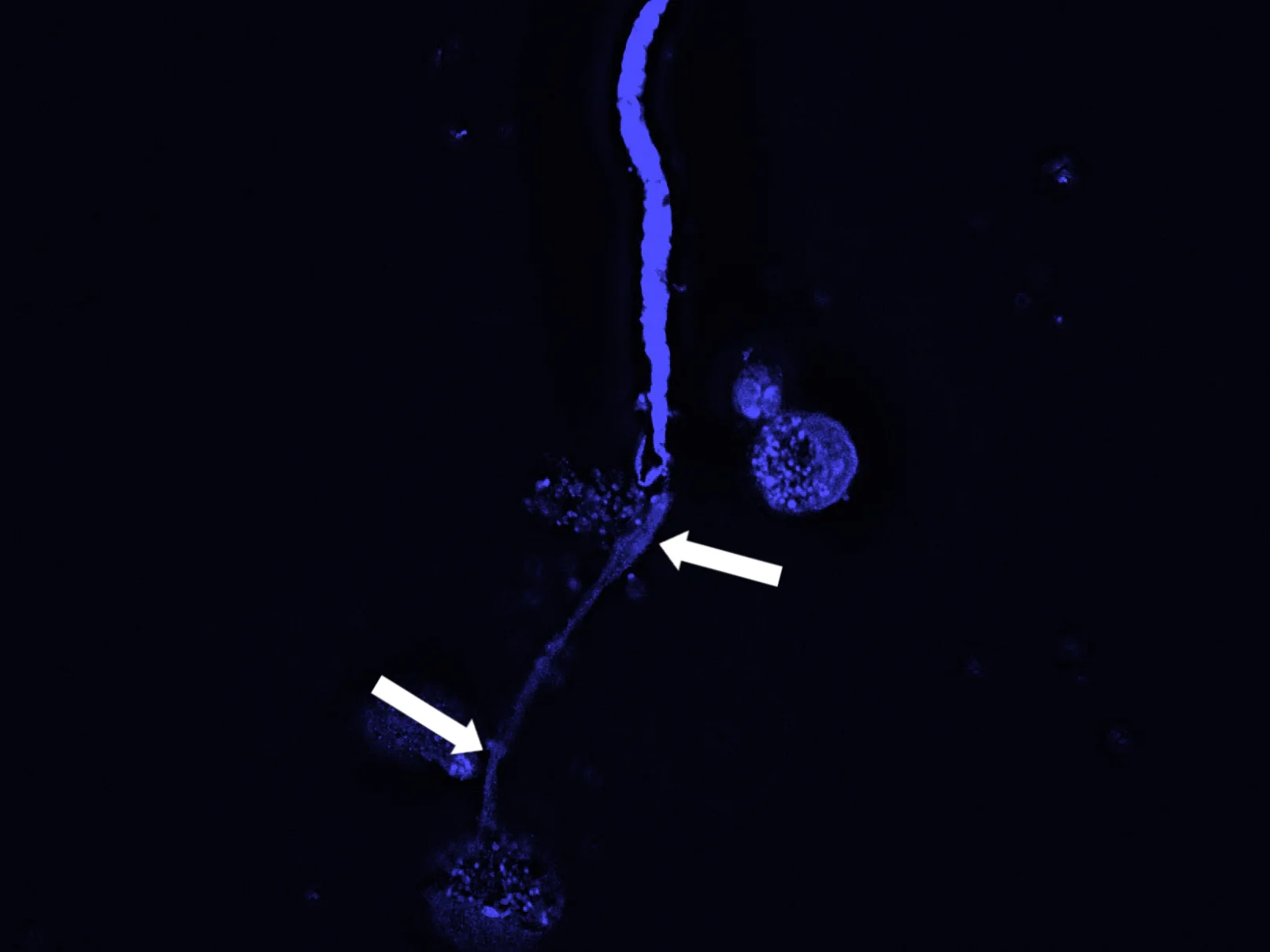 A trap for nematodes