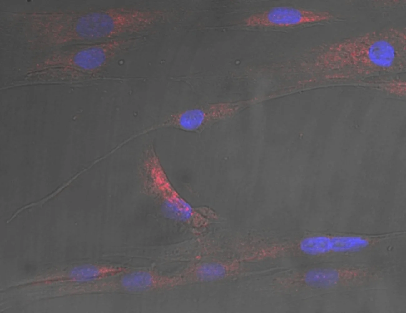 Higher blood fats make cells share stress