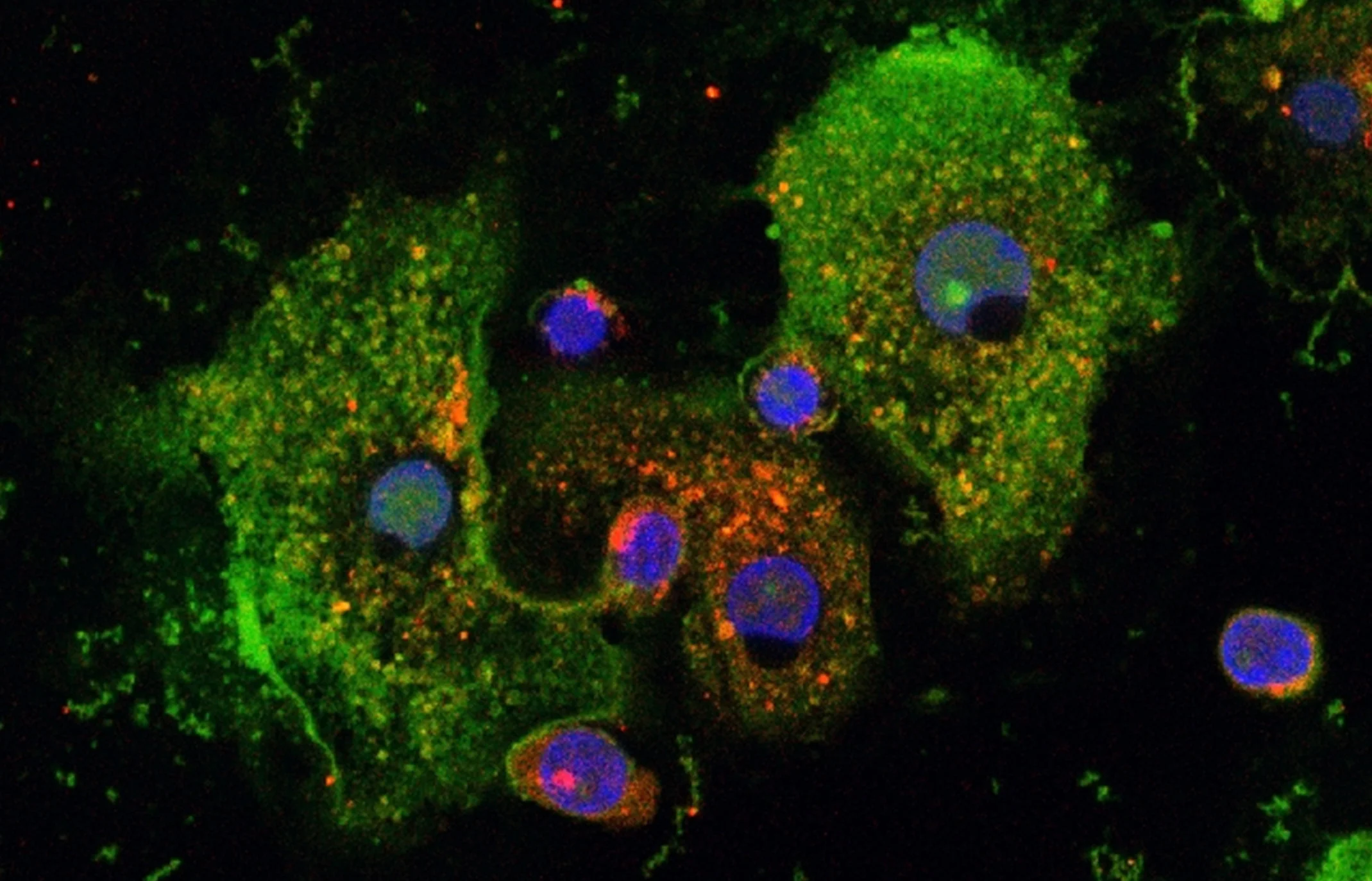 Asthma: New Mechanism of Action Curbs Inflammatory Response