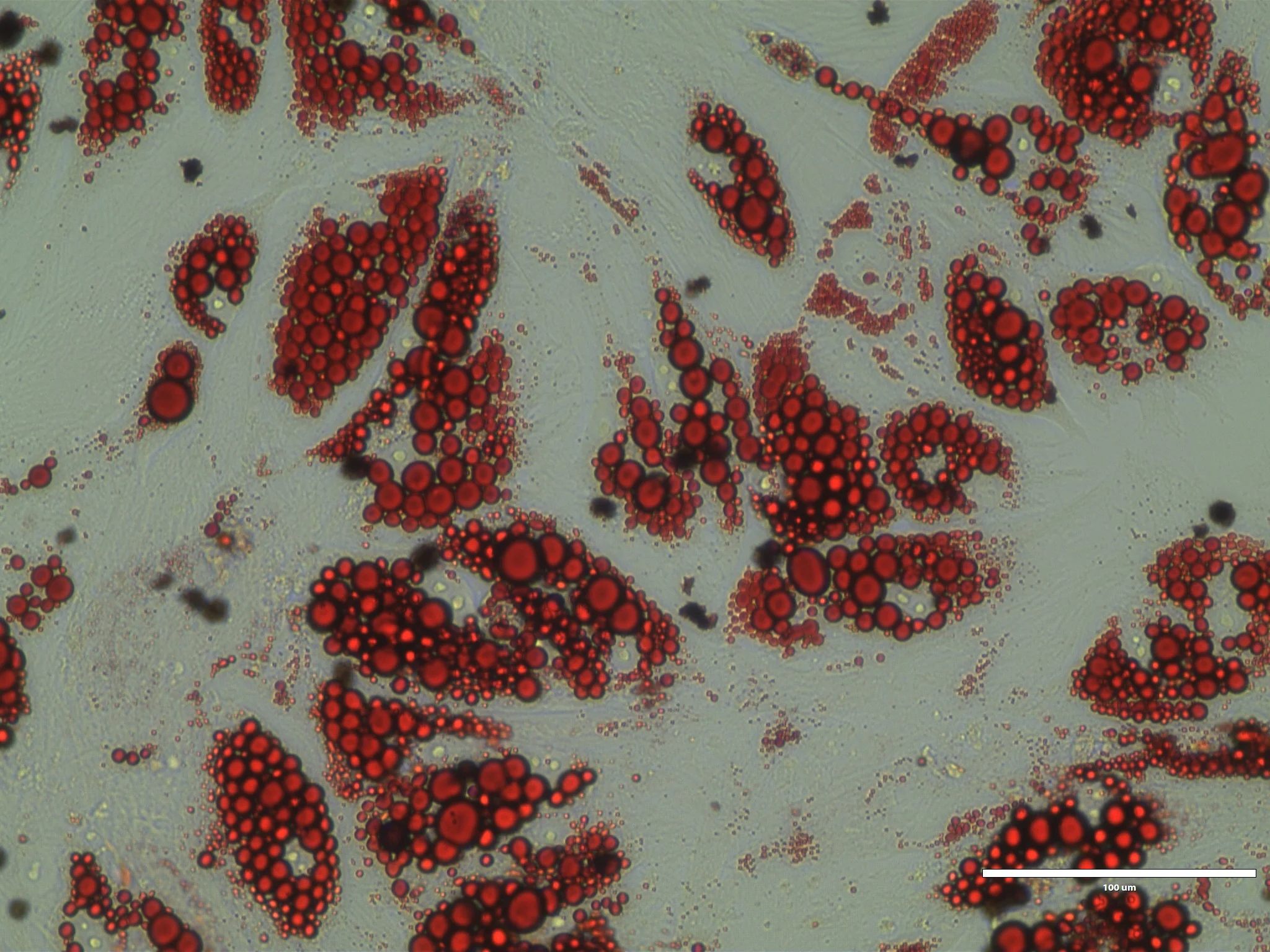Molecule boosts fat burning