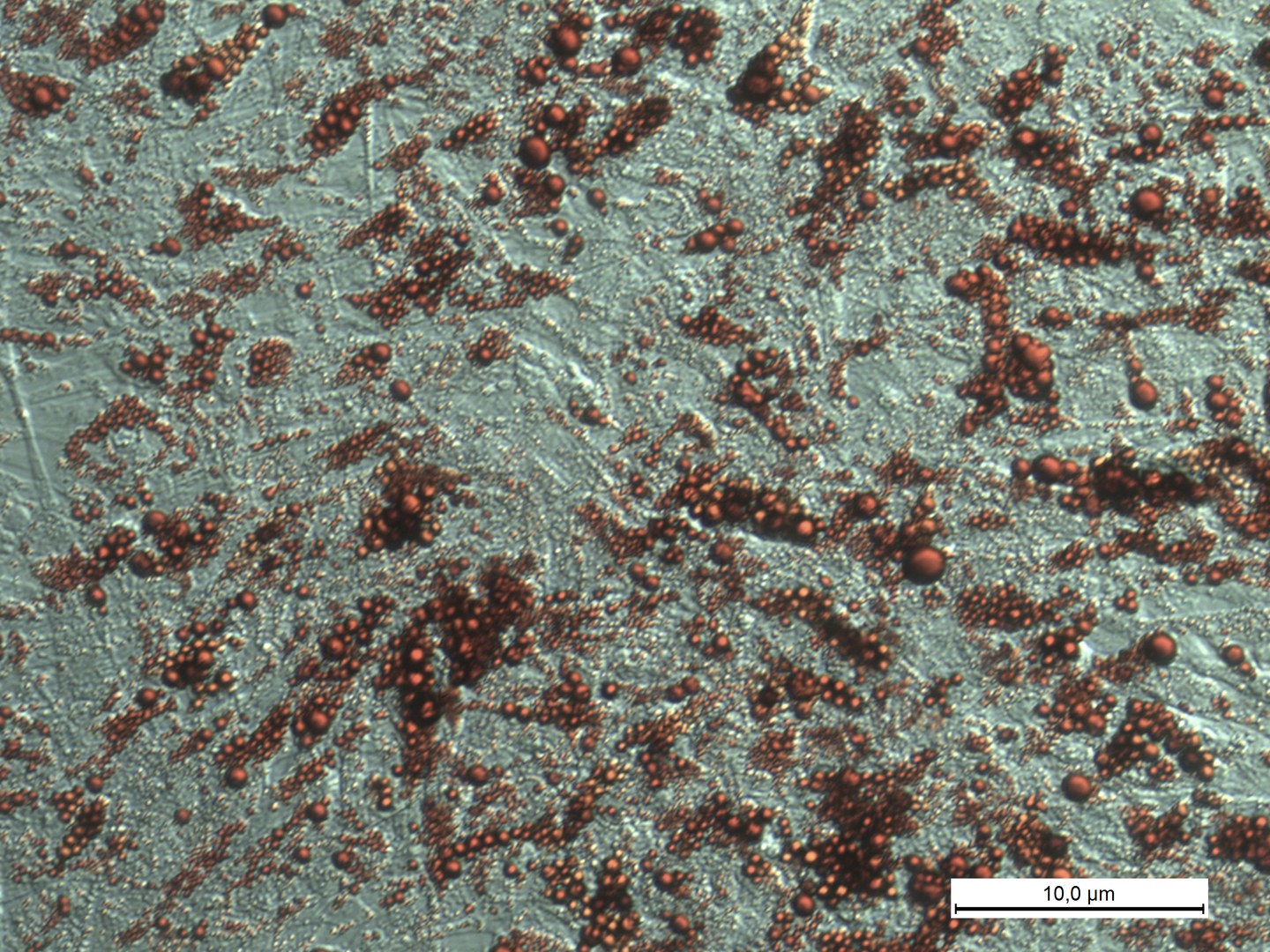 Human brown adipocytes, lipid stained red (RedO oil stain)