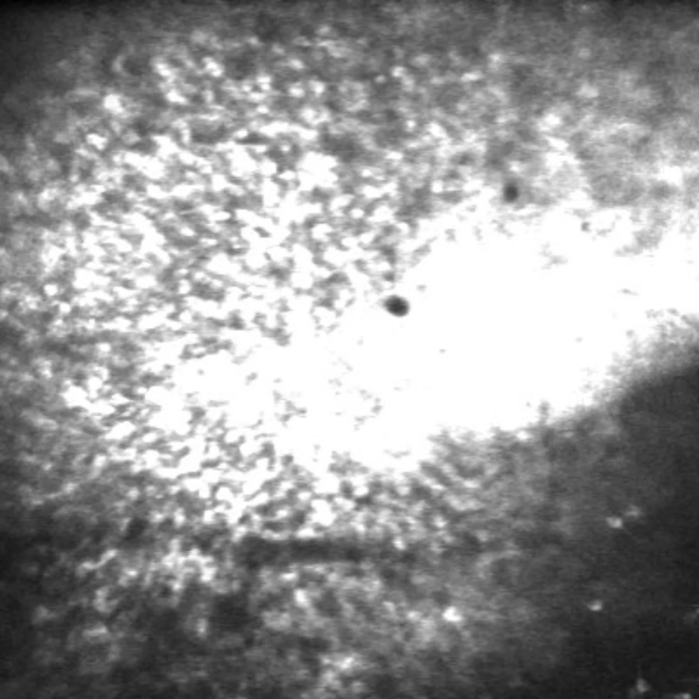 Fluorescence microscopy: