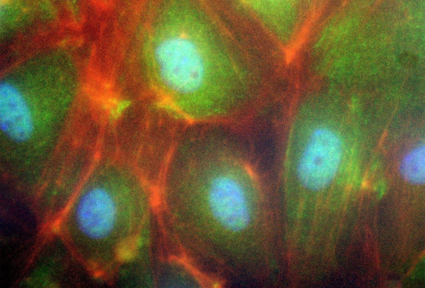 In the fluorescence microscope: