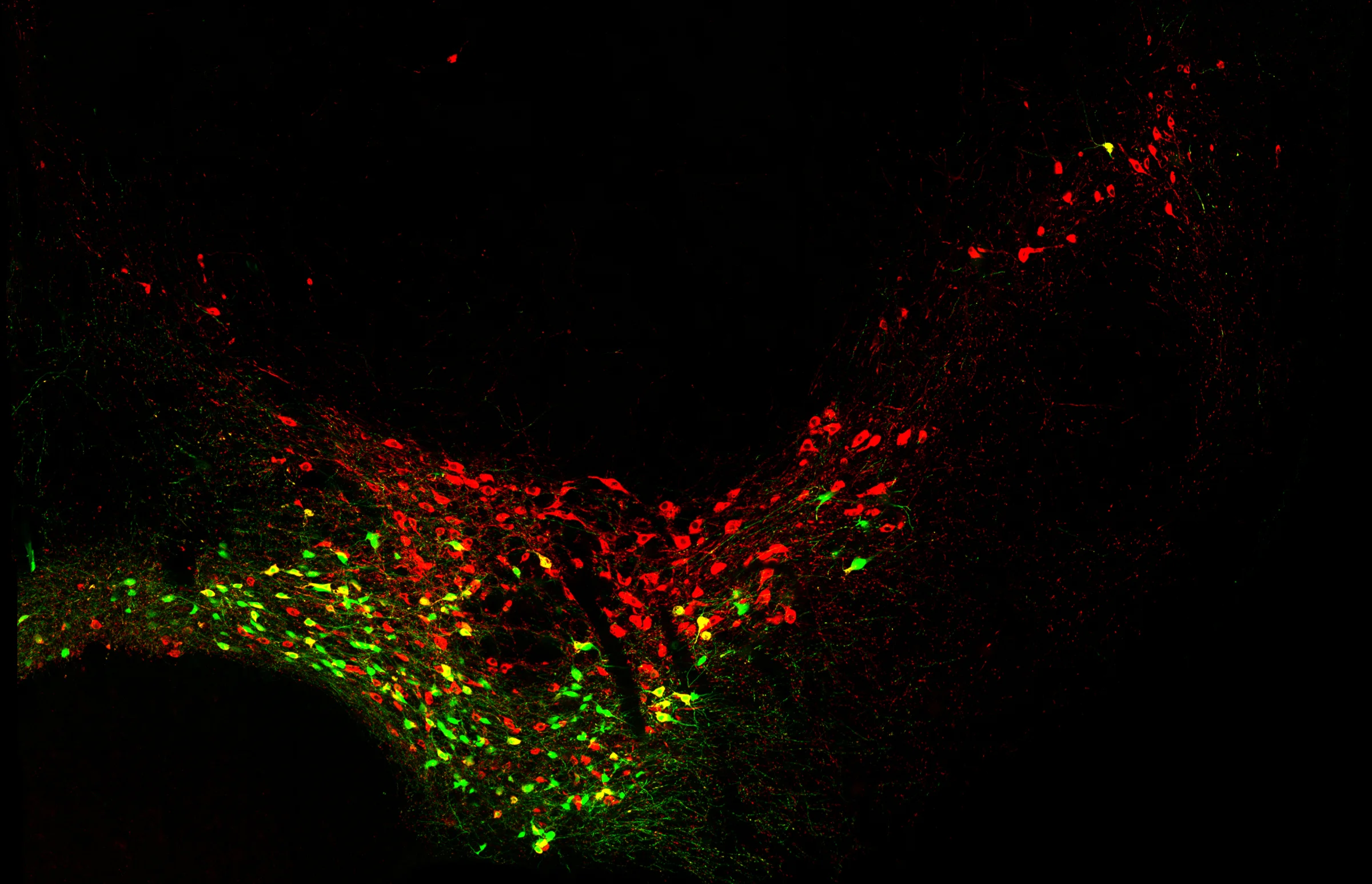 Many paths are open to neurons born early