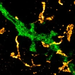 Single fragment of a neuron