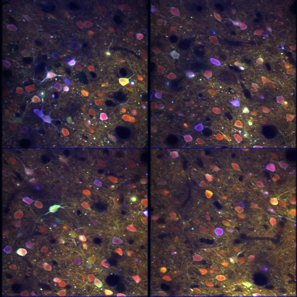 How does the brain change through learning?