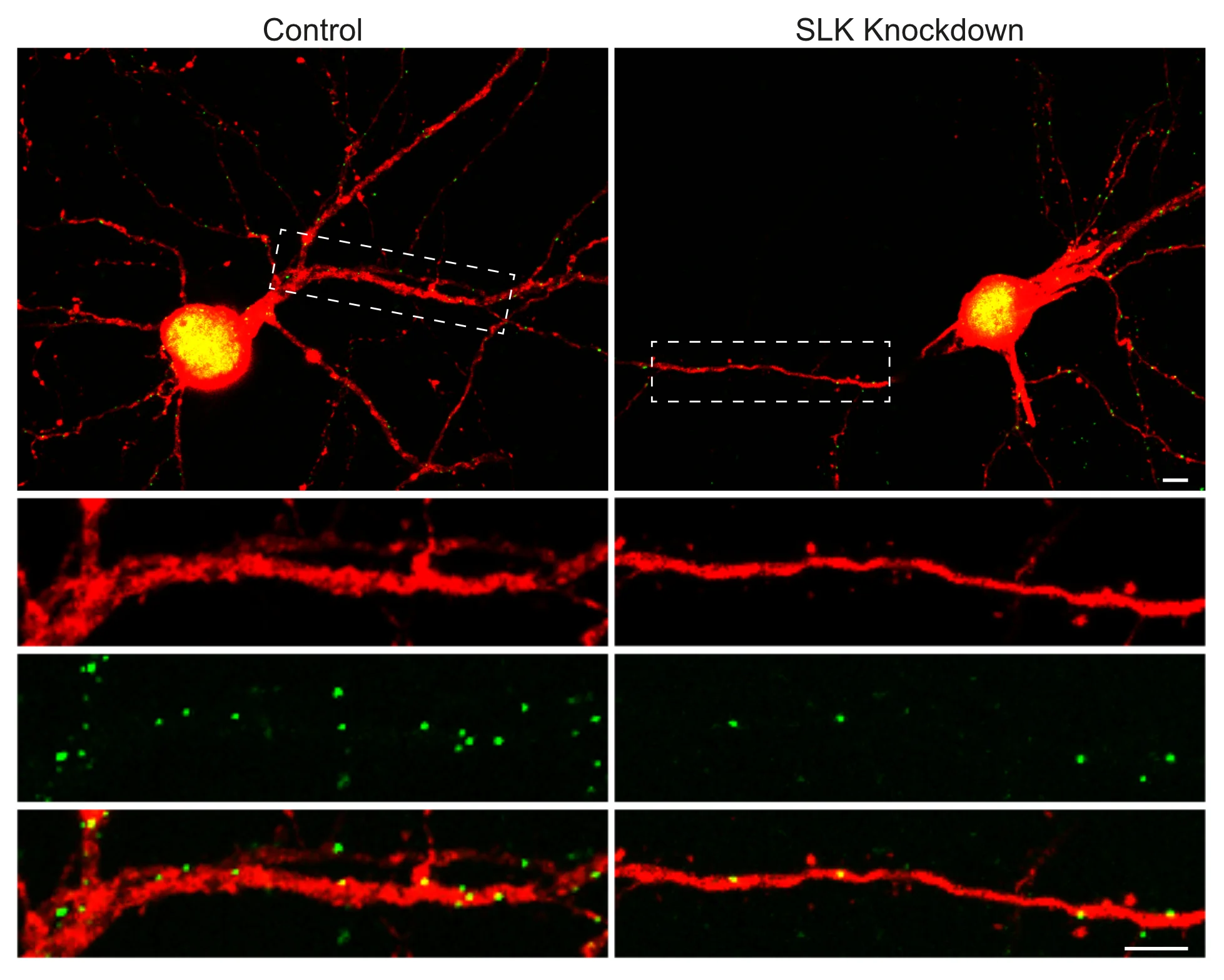 How neurons regulate their excitability autonomously