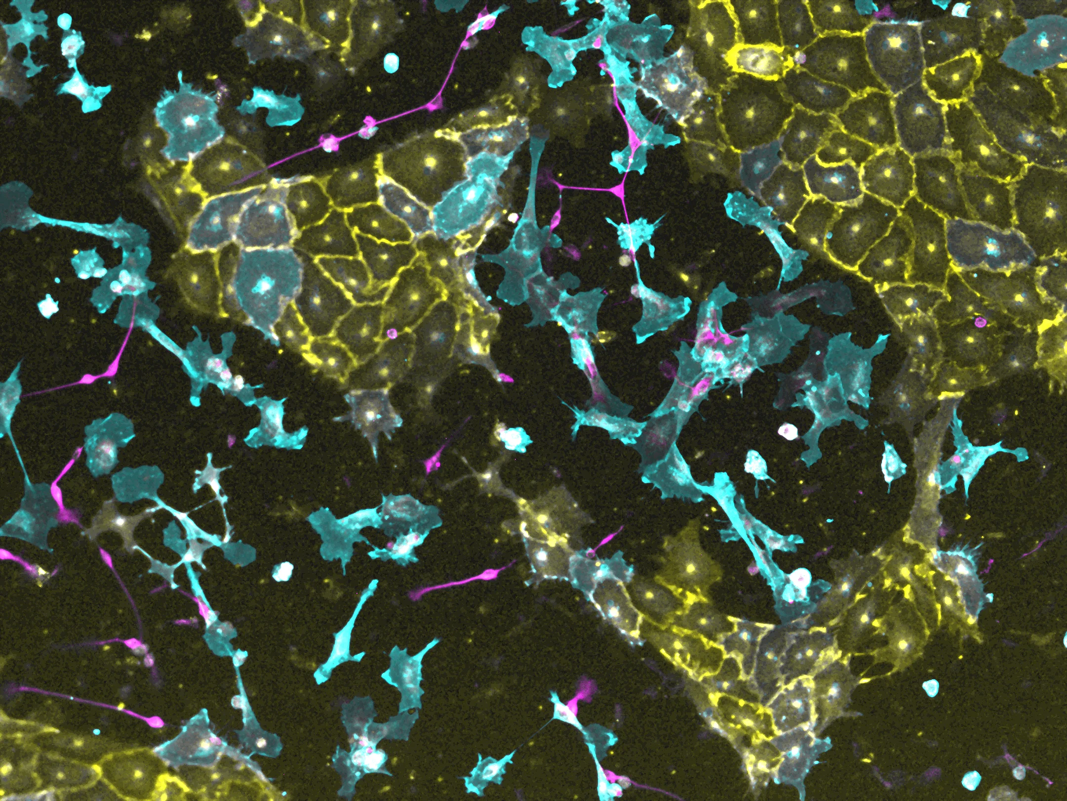 Customized programming of human stem cells
