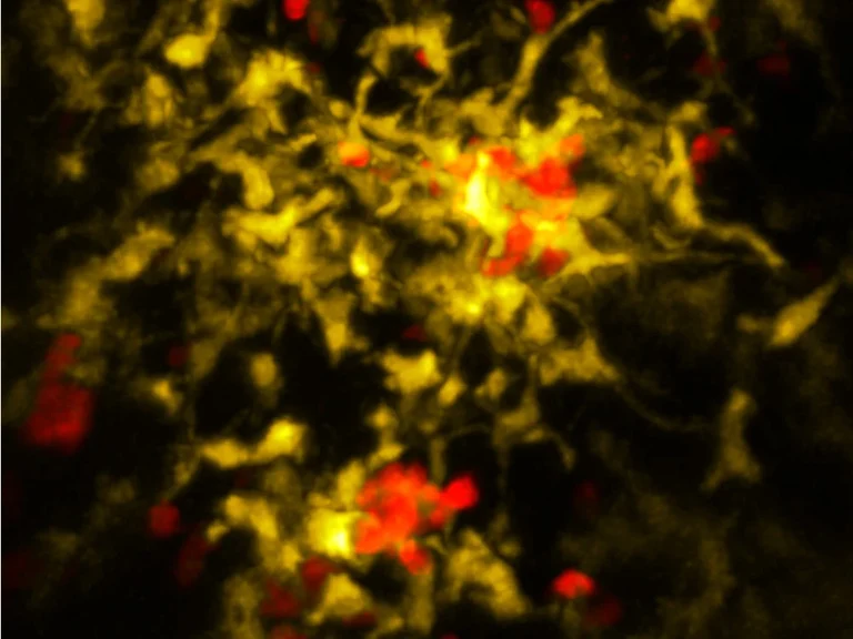 Once killer cells (red)