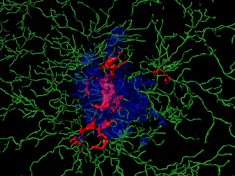 Inflammatory proteins (called “ASC specks”, red)