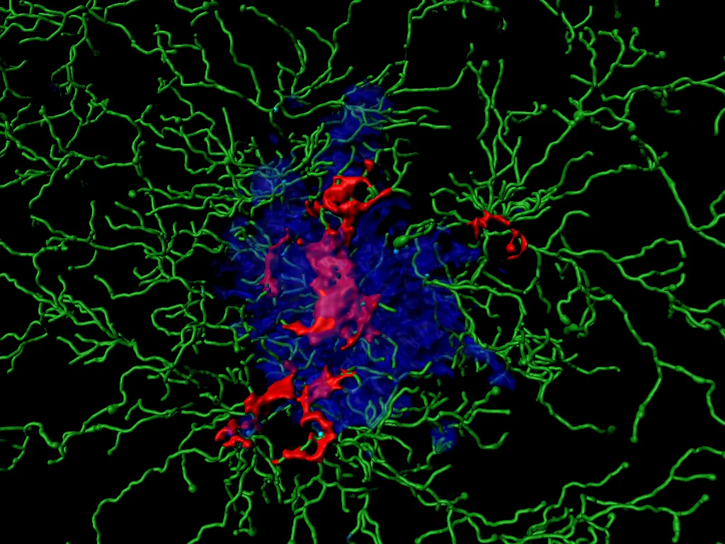 Inflammatory proteins (called “ASC specks”, red)