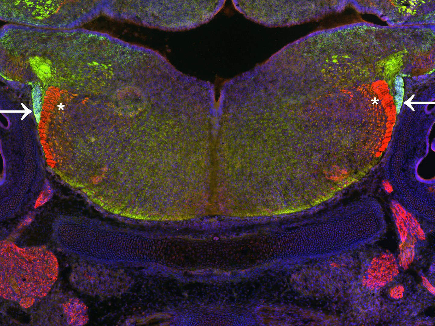 Section through the hindbrain of the mouse during development.