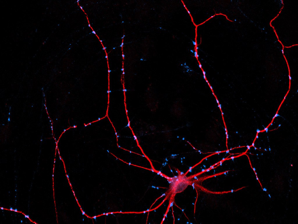 Image of a “single” neuron: