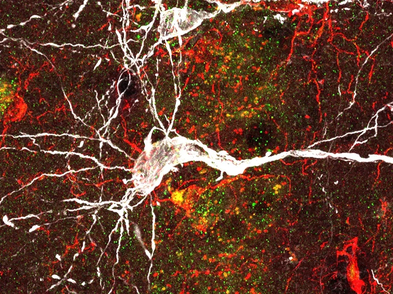 A microscopic view of a neuron (white),