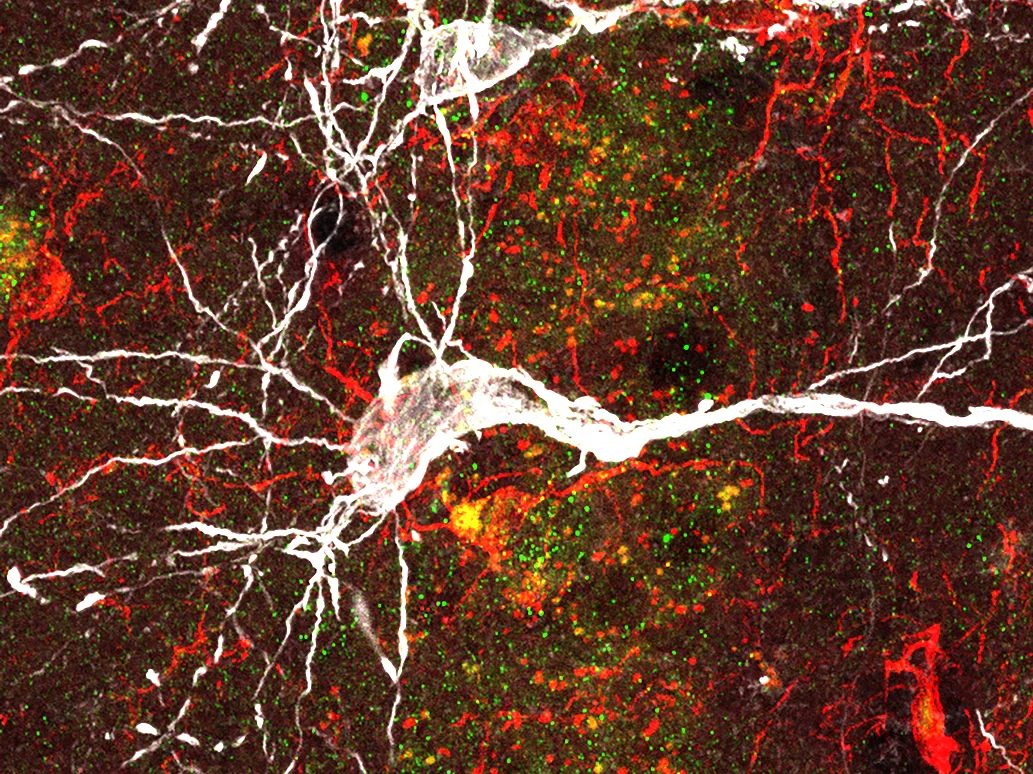 A microscopic view of a neuron (white),